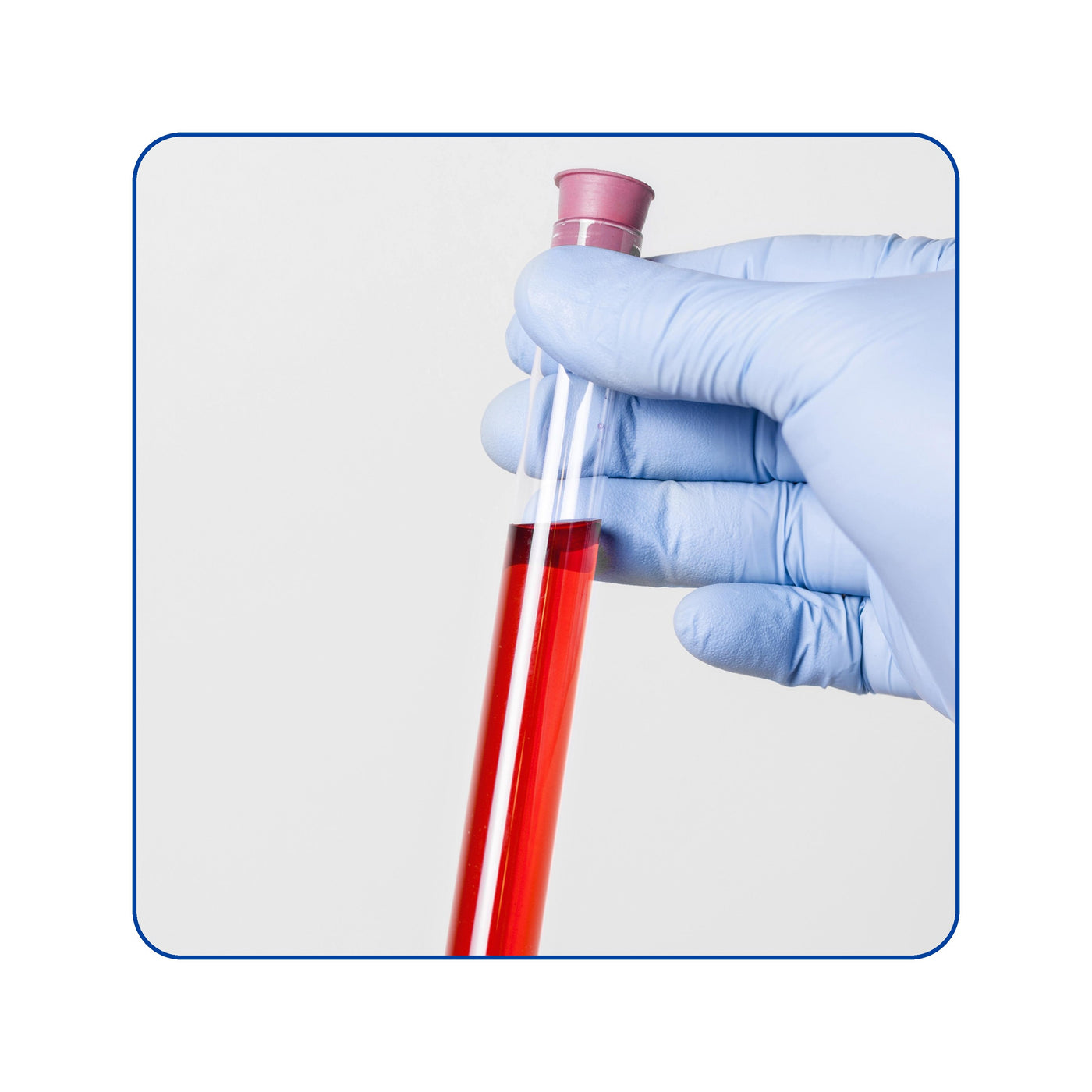 Intrinsic Genomics DNA Test